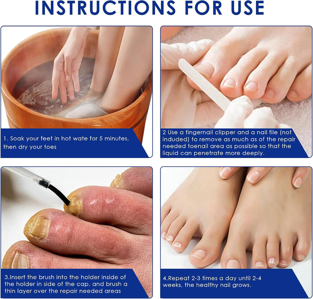 30Ml Nail Treatment,Nail Fungus Treatment for Toenail & Fingernails, Protects Thick, Broken and Discolored Nails