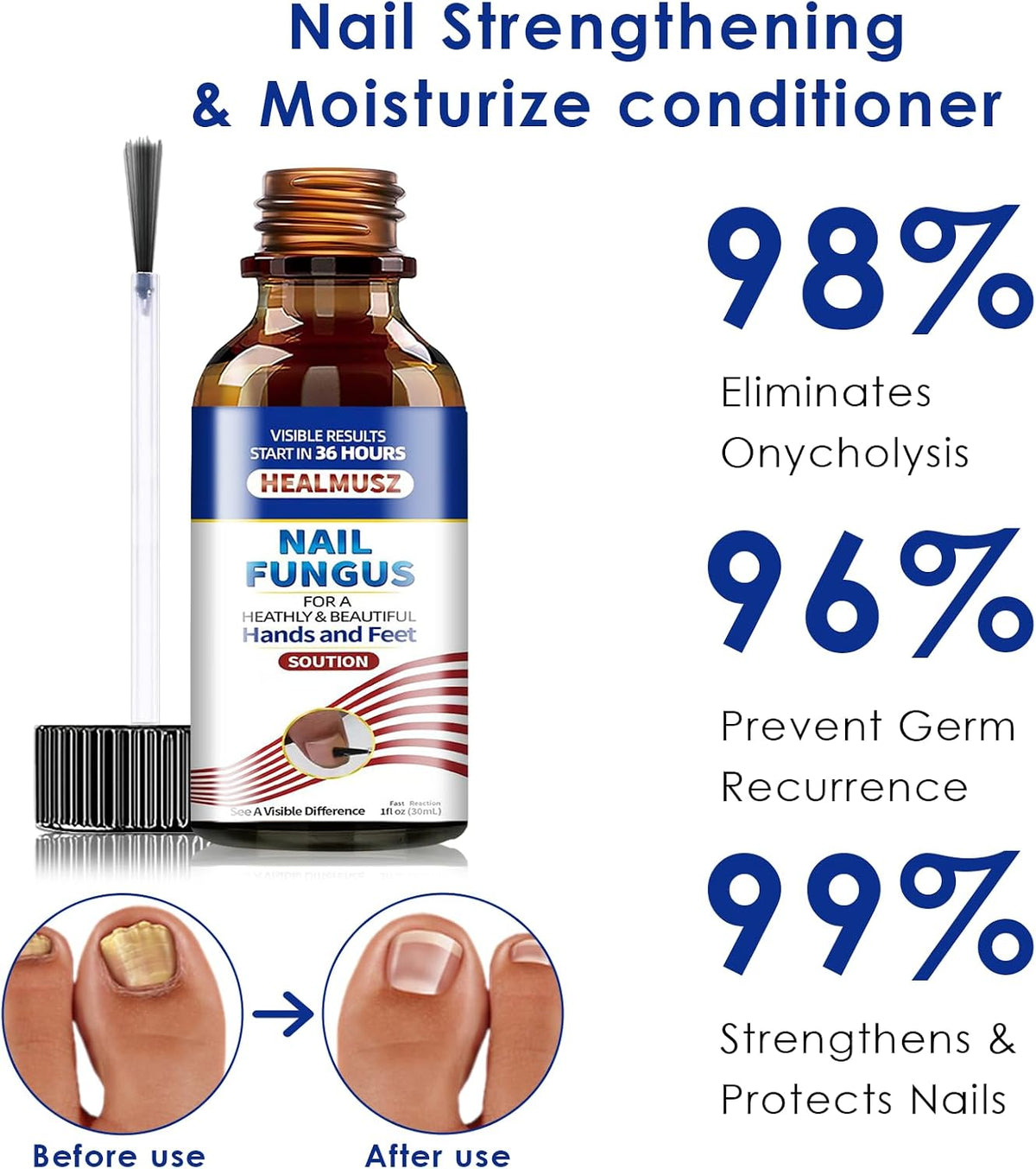 30Ml Nail Treatment,Nail Fungus Treatment for Toenail & Fingernails, Protects Thick, Broken and Discolored Nails