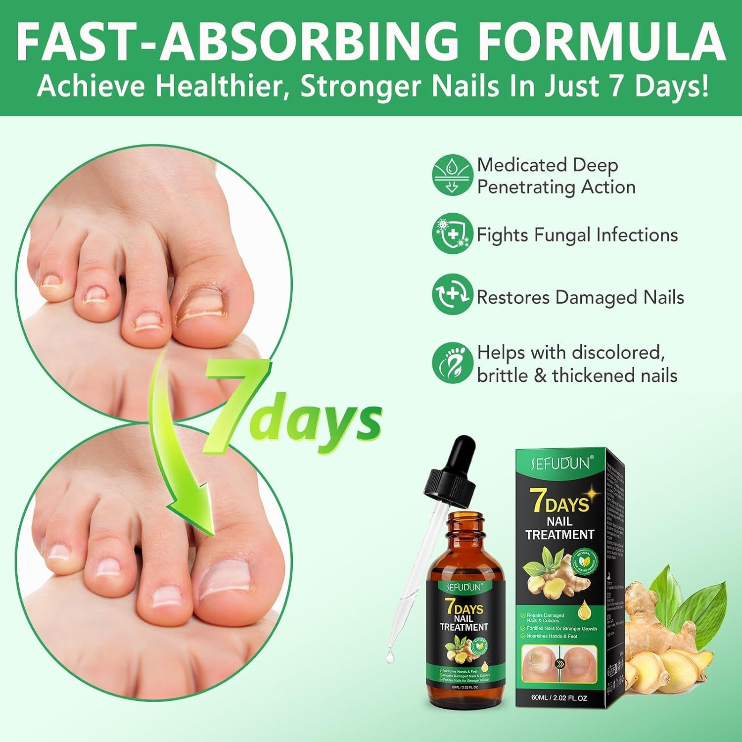 Fungal Nail Treatment, Ginger Nail Fungal Treatment for Finger & Toenail, Multi-Purpose Nail Repair, Nail Solution for Discolored, Damaged Nails and Thick Toenails, 60Ml