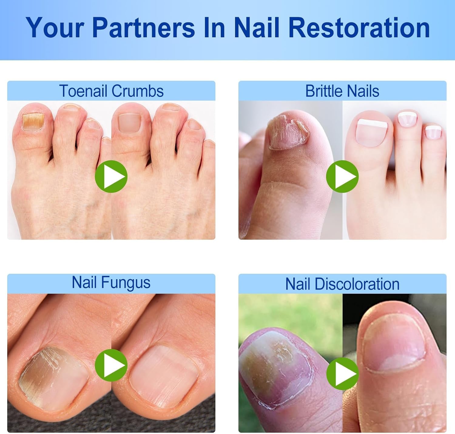 60Pcs Nail Repair Patches, Fungal Nail Treatments for Toenails Extra Strong, Ingrown Toenail & Keratin Nails Treatment Patches, anti Fungal Toenail Treatment, Restores Healthy Nails