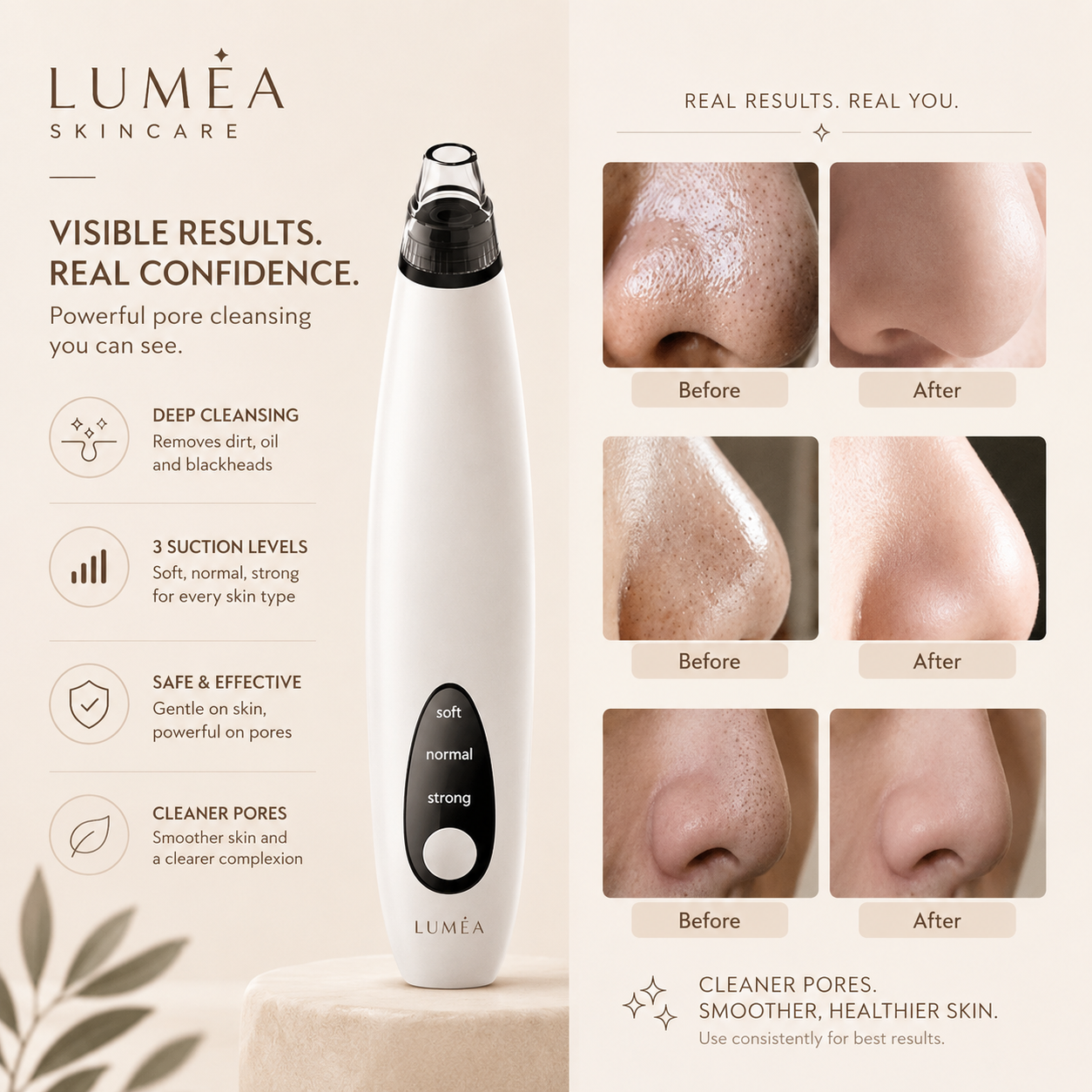 Luméa™ Blackhead Remover Vacuum