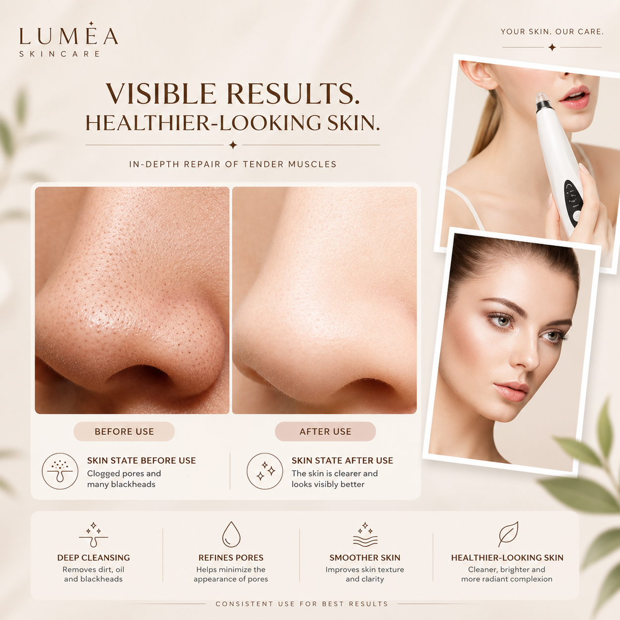 Luméa™ Blackhead Remover Vacuum
