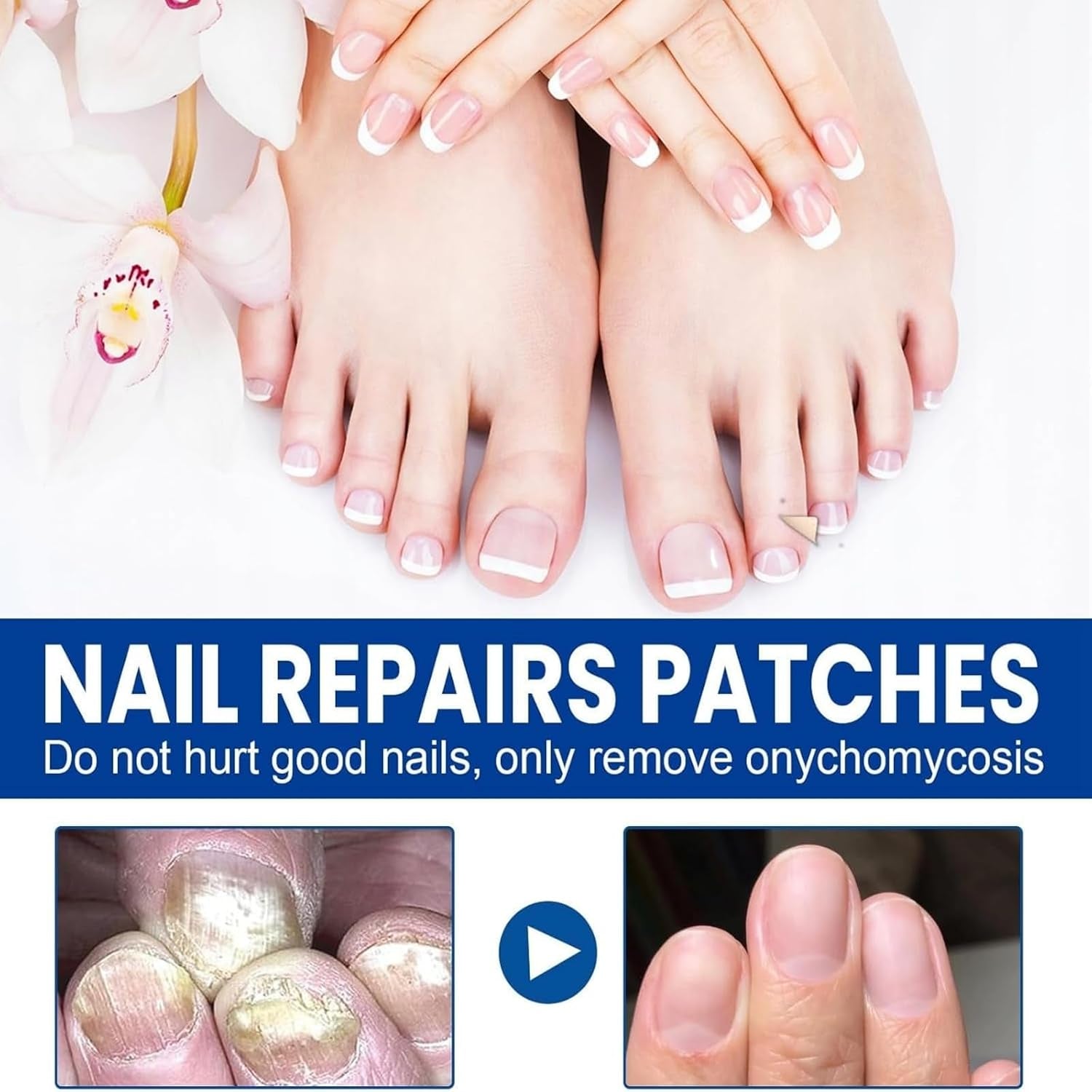 60Pcs Nail Repair Patches, Fungal Nail Treatments for Toenails Extra Strong, Ingrown Toenail & Keratin Nails Treatment Patches, anti Fungal Toenail Treatment, Restores Healthy Nails